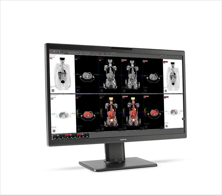 Medical scans on computer screen
