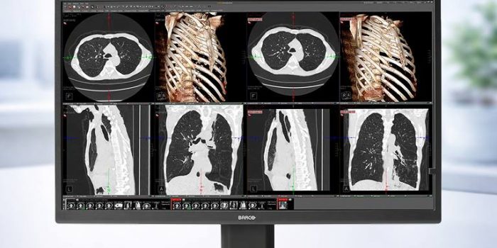 Medical scans on computer screen