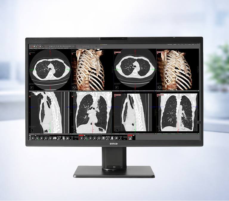 Medical scans on computer screen