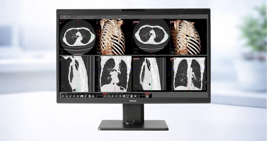 Medical scans on computer screen