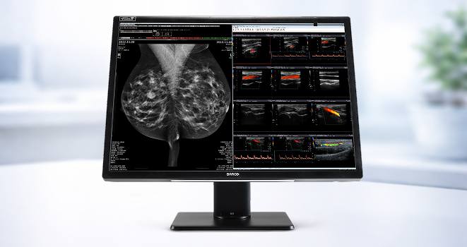 Medical scans on computer screen
