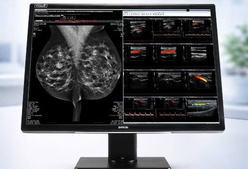 Medical scans on computer screen