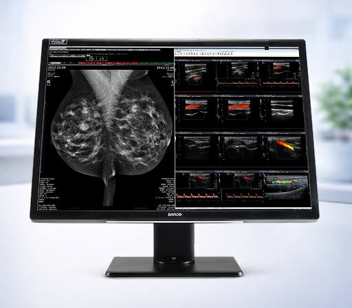 Medical scans on computer screen