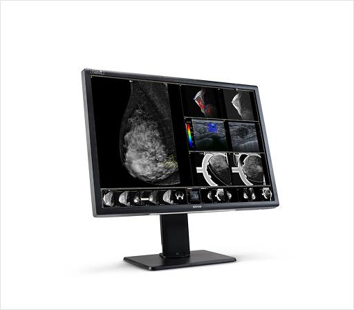Medical scans on computer screen