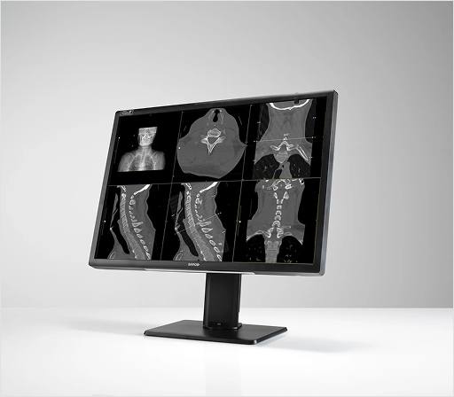 Medical scans on computer screen