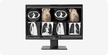 Medical scans on computer screen