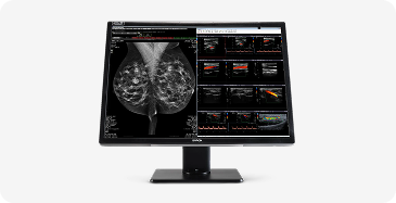 Medical scans on computer screen