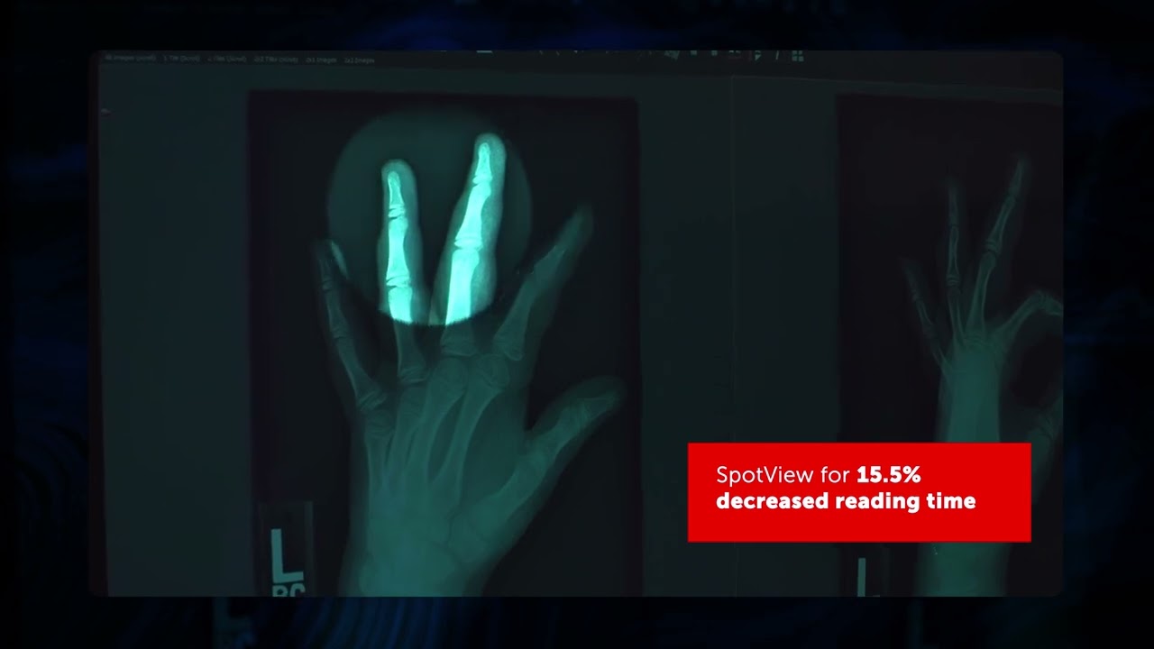 SpotView x-rays